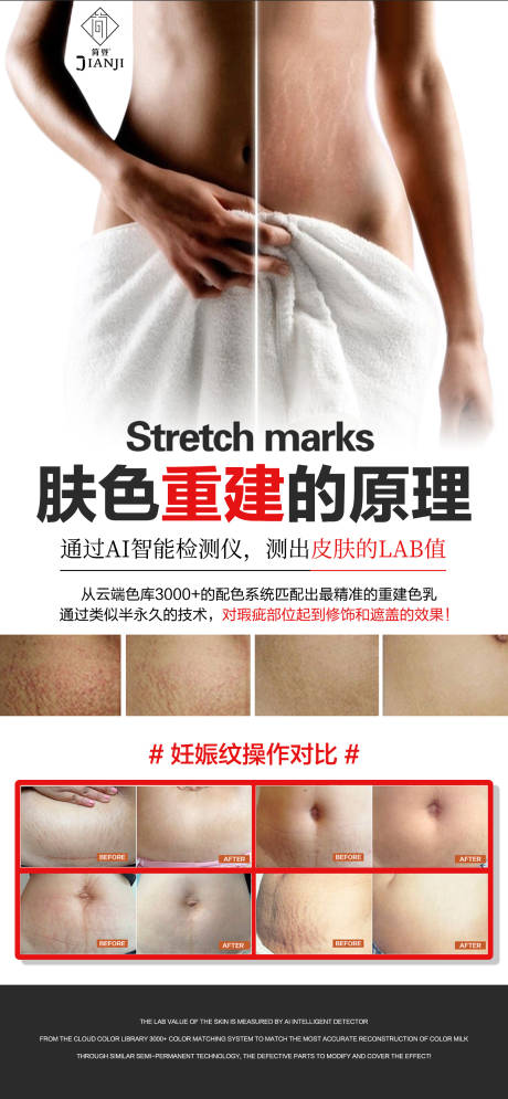 源文件下载【享设计】搜索编号：24170035934176036【医美妊娠纹对比海报】