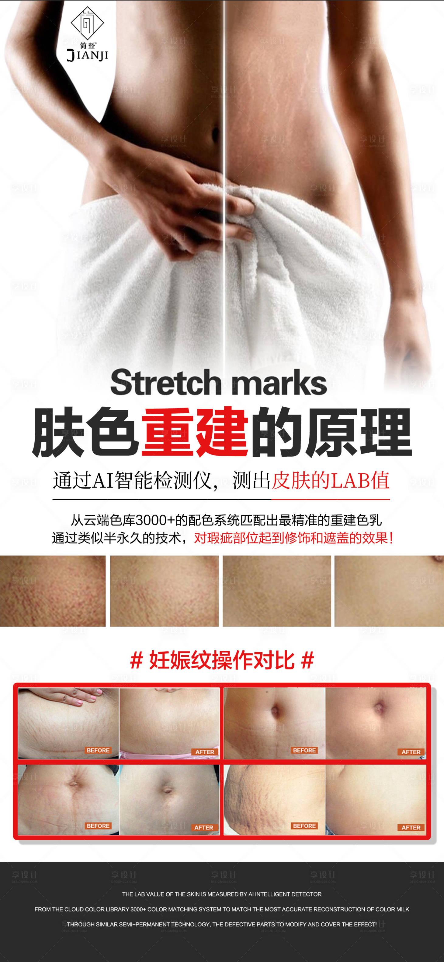 源文件下载【享设计】搜索编号：24170035934176036【医美妊娠纹对比海报】