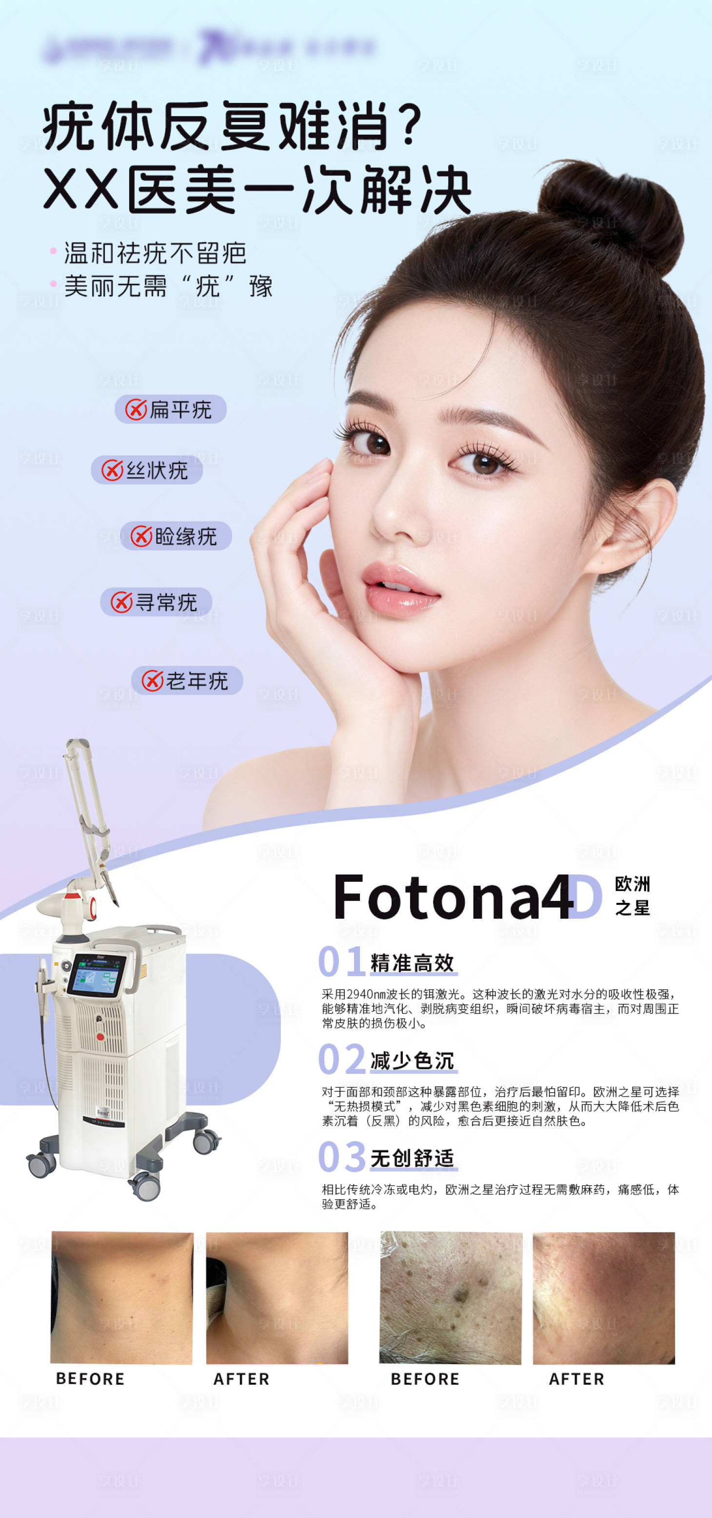 源文件下载【享设计】搜索编号：67730035987348638【医美专业祛疣海报】
