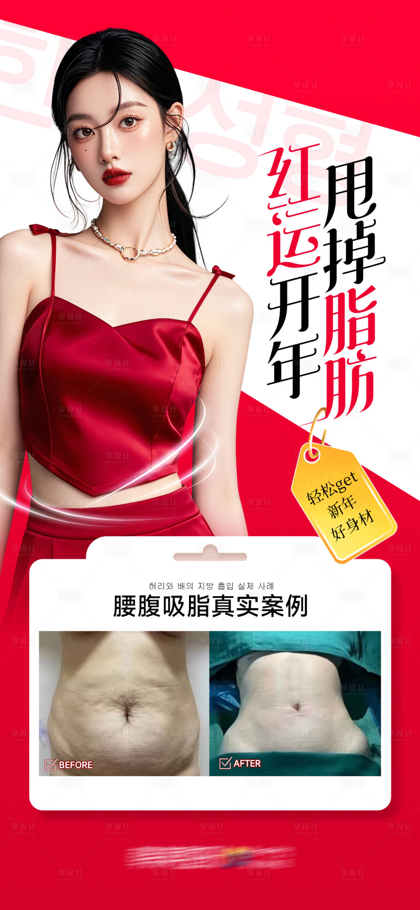 源文件下载【享设计】搜索编号：46860035987713420【腰腹吸脂真实案例海报】