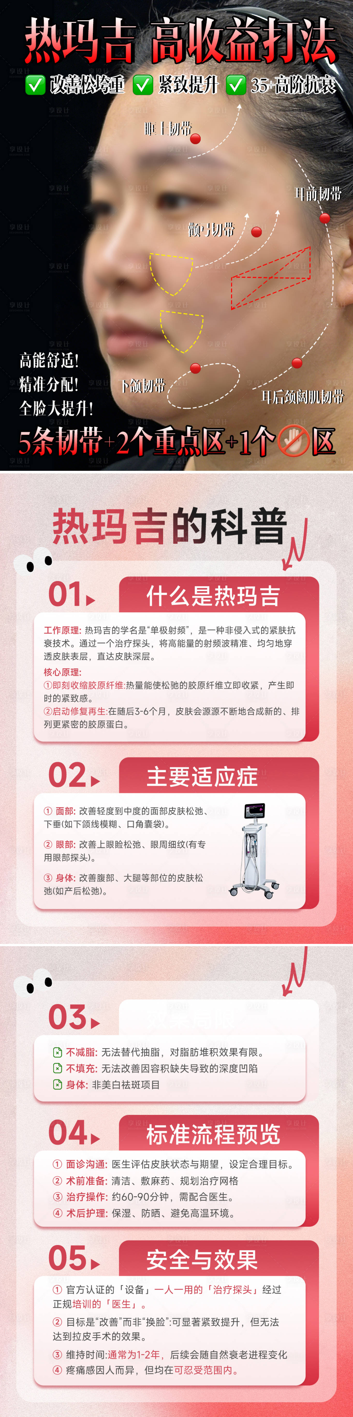 源文件下载【享设计】搜索编号：15660035931416523【热玛吉高收益打发科普】