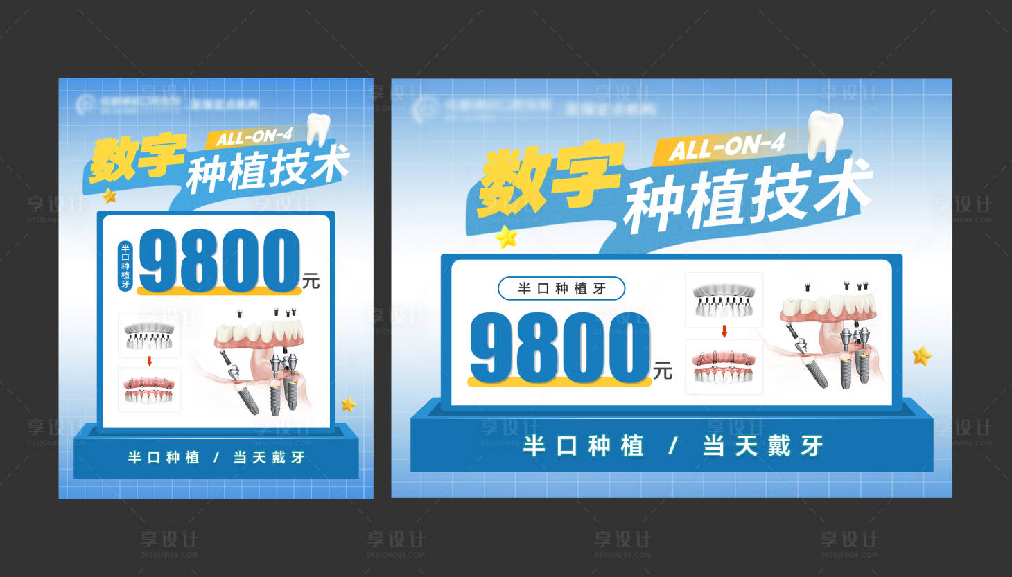 源文件下载【享设计】搜索编号：36250035817927416【数字种植技术】