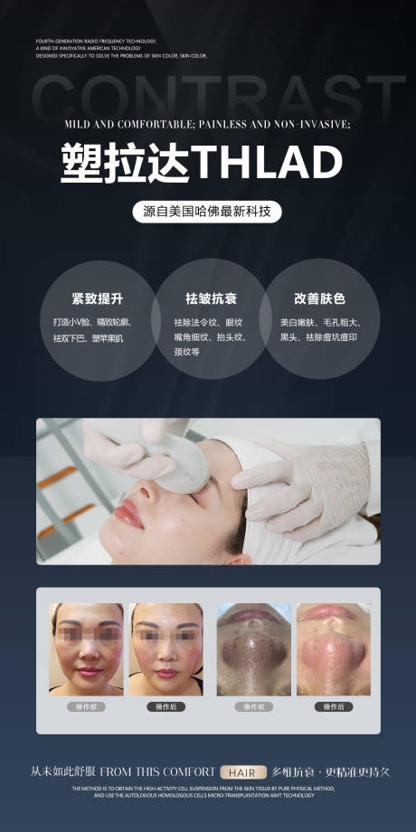 源文件下载【享设计】搜索编号：83620036101052039【医美仪器海报】
