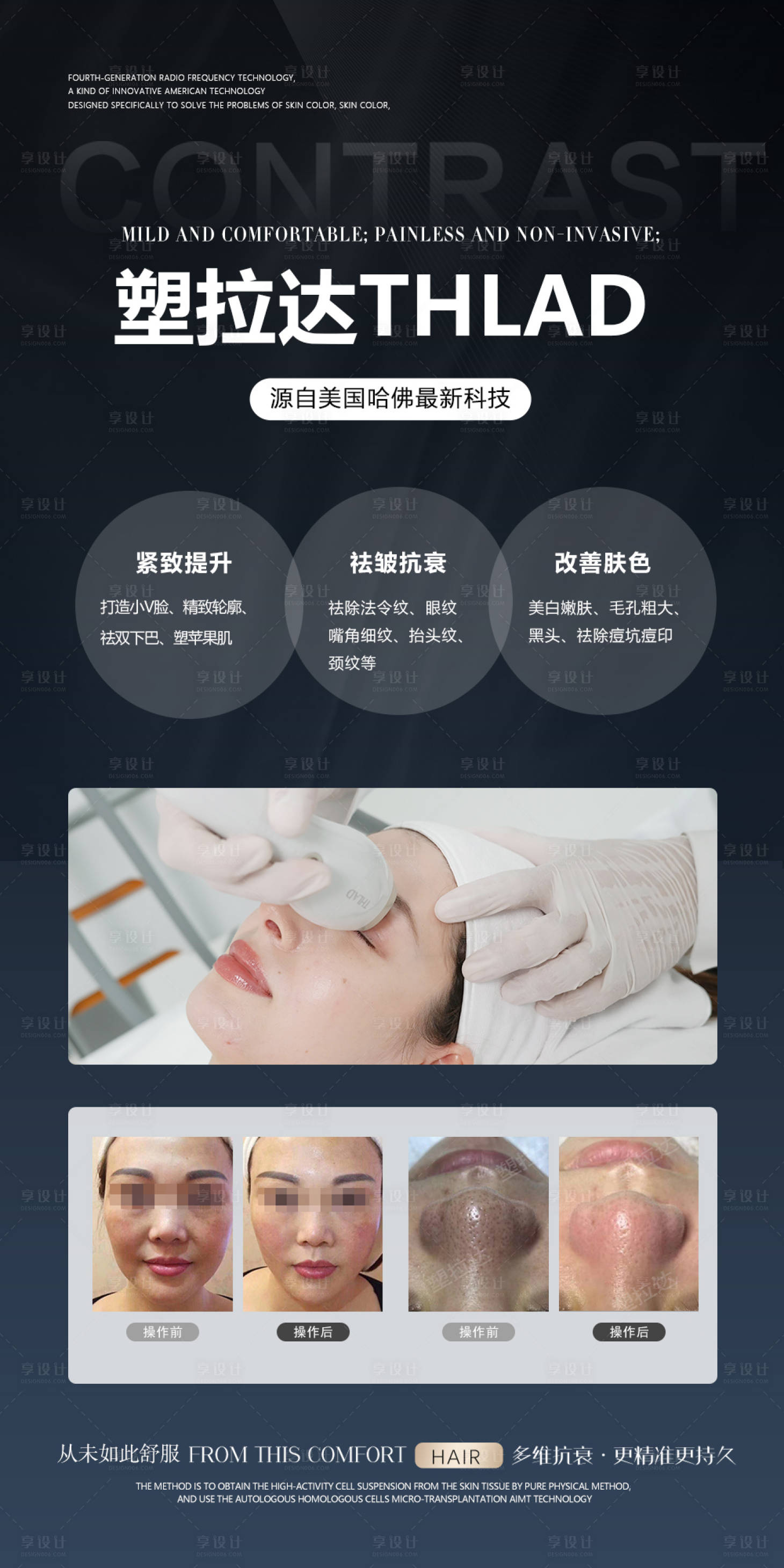 源文件下载【享设计】搜索编号：83620036101052039【医美仪器海报】