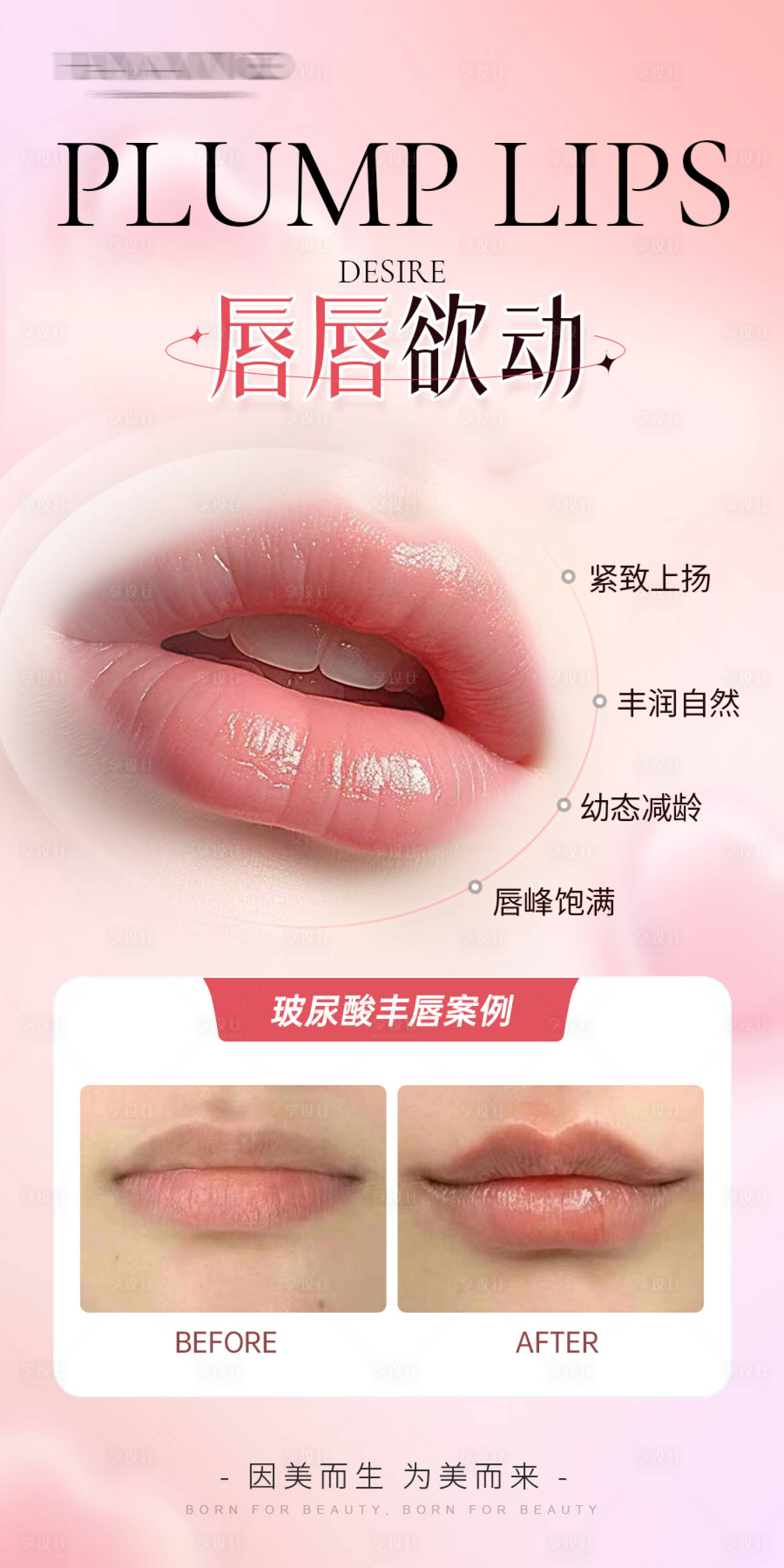 源文件下载【享设计】搜索编号：72070036158526348【医美嘴唇唇部口周年轻化塑形案例海报】