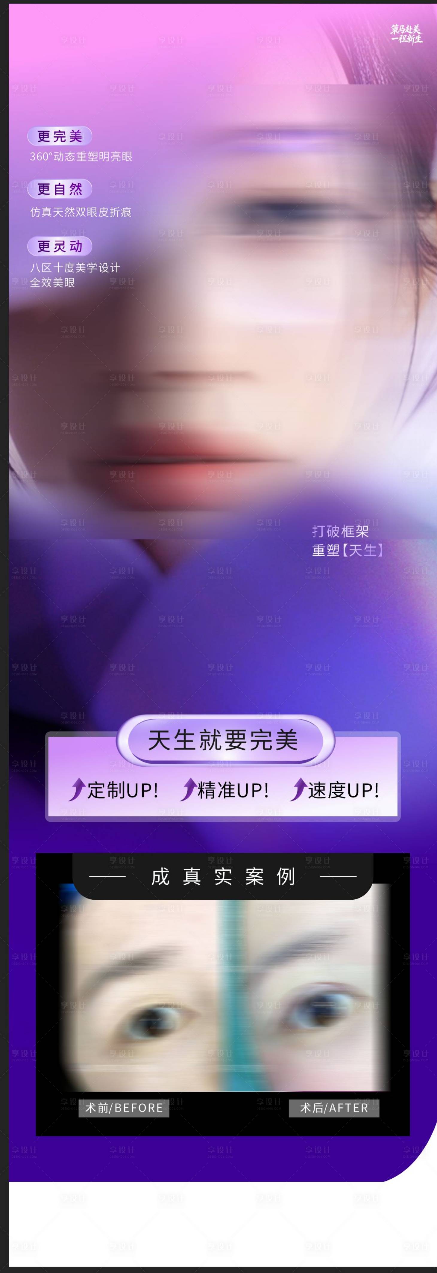 源文件下载【享设计】搜索编号：56790035945294717【医美美眼案例海报】
