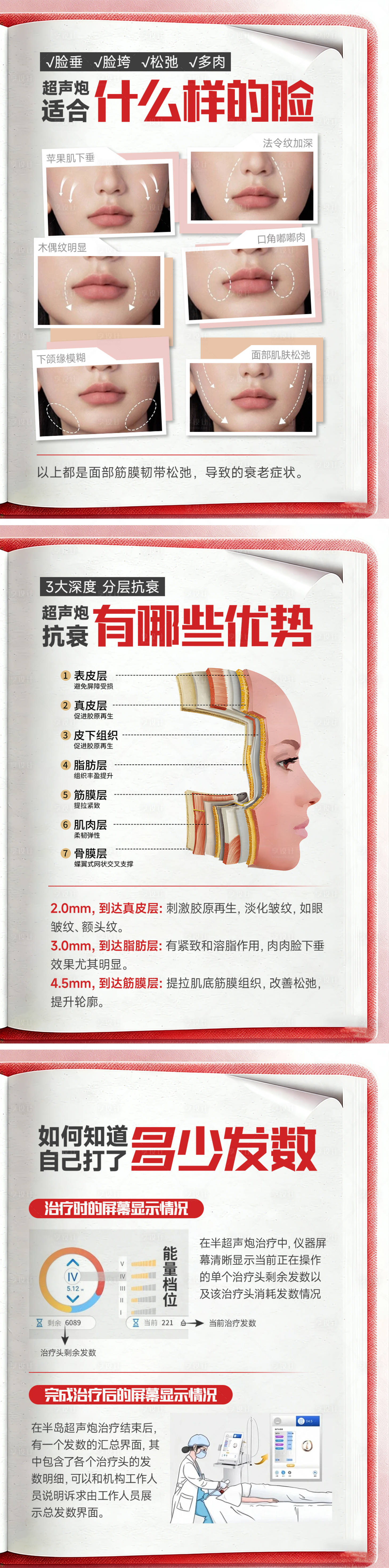 源文件下载【享设计】搜索编号：32480036144343189【医美小红书超声炮套图】