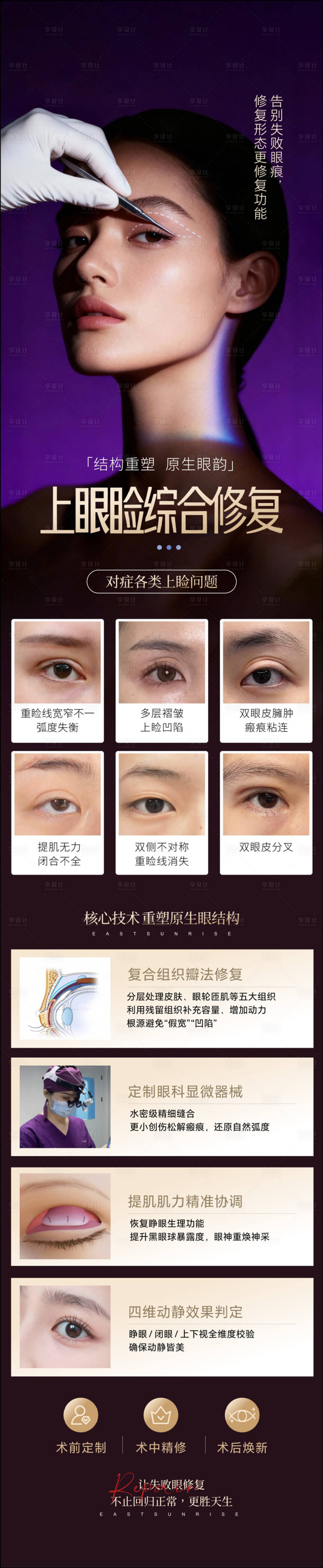 源文件下载【享设计】搜索编号：94940035996295391【上眼睑综合修复】
