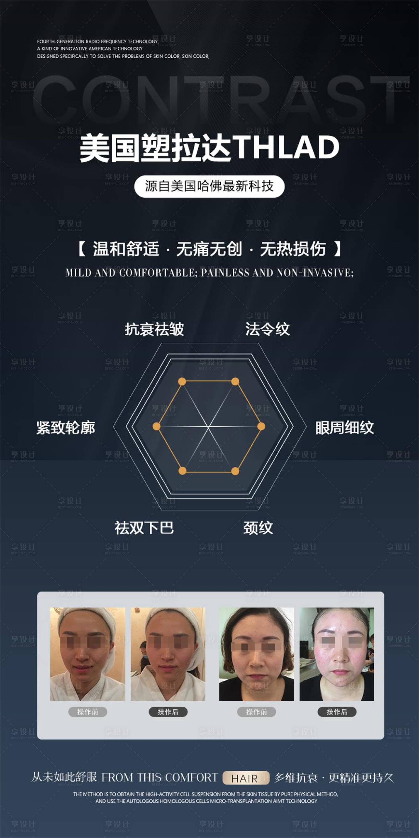 源文件下载【享设计】搜索编号：75620036101043661【医美仪器海报】