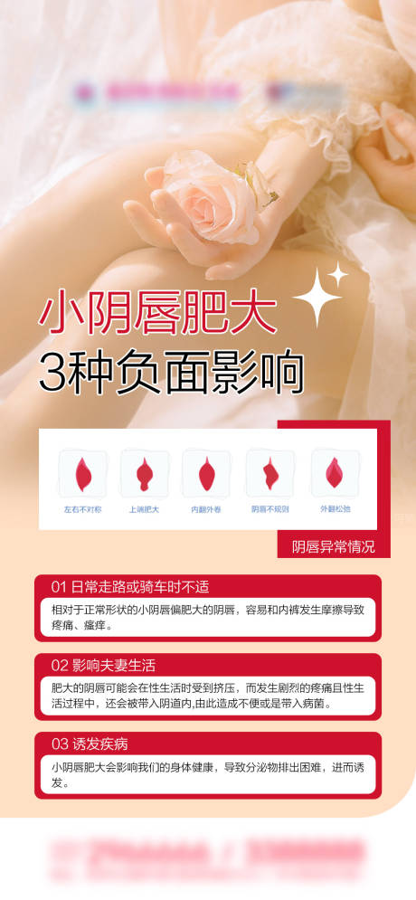 源文件下载【享设计】搜索编号：91930035967941443【小阴唇肥大种负面影响科普海报】