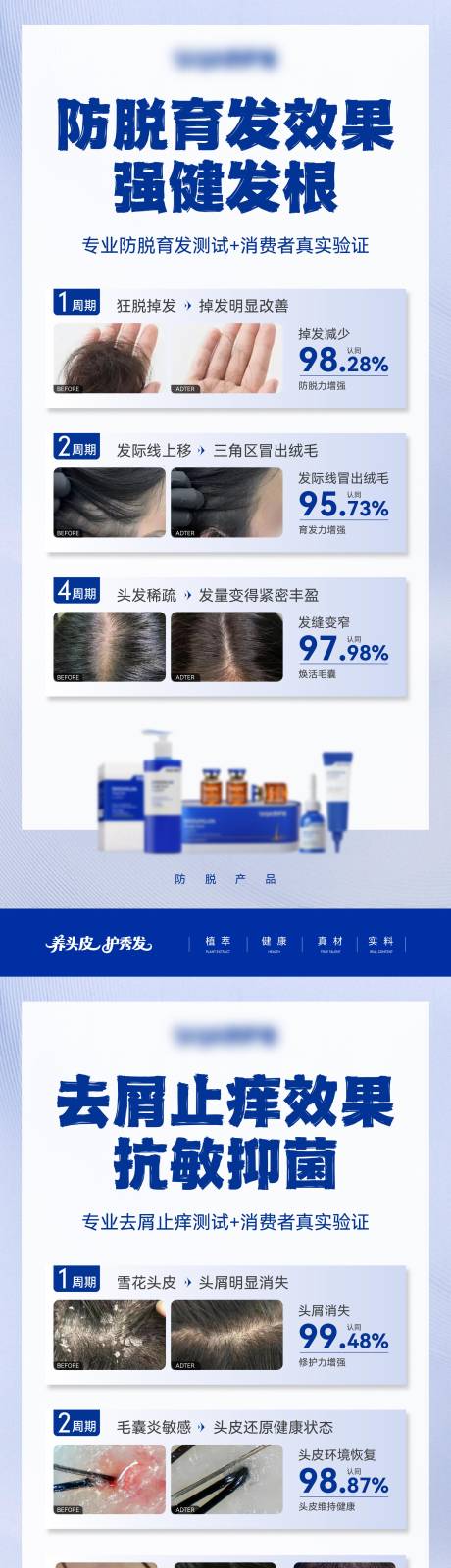 源文件下载【享设计】搜索编号：39880035933951216【防脱去屑控油洗发水案例对比海报】