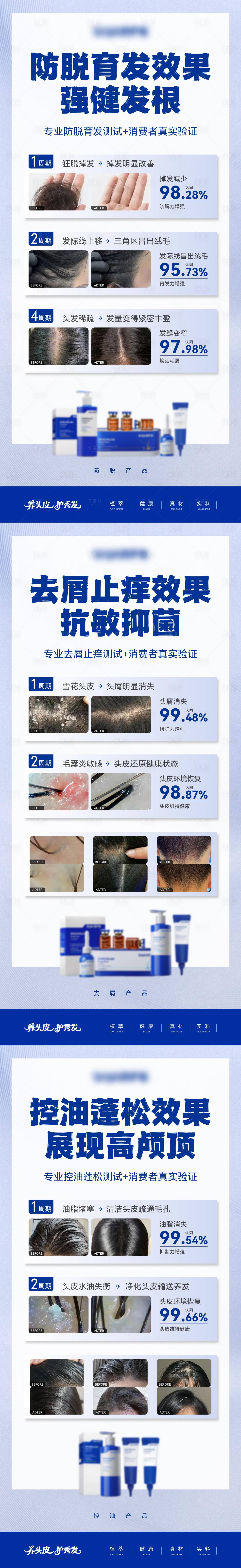 源文件下载【享设计】搜索编号：39880035933951216【防脱去屑控油洗发水案例对比海报】