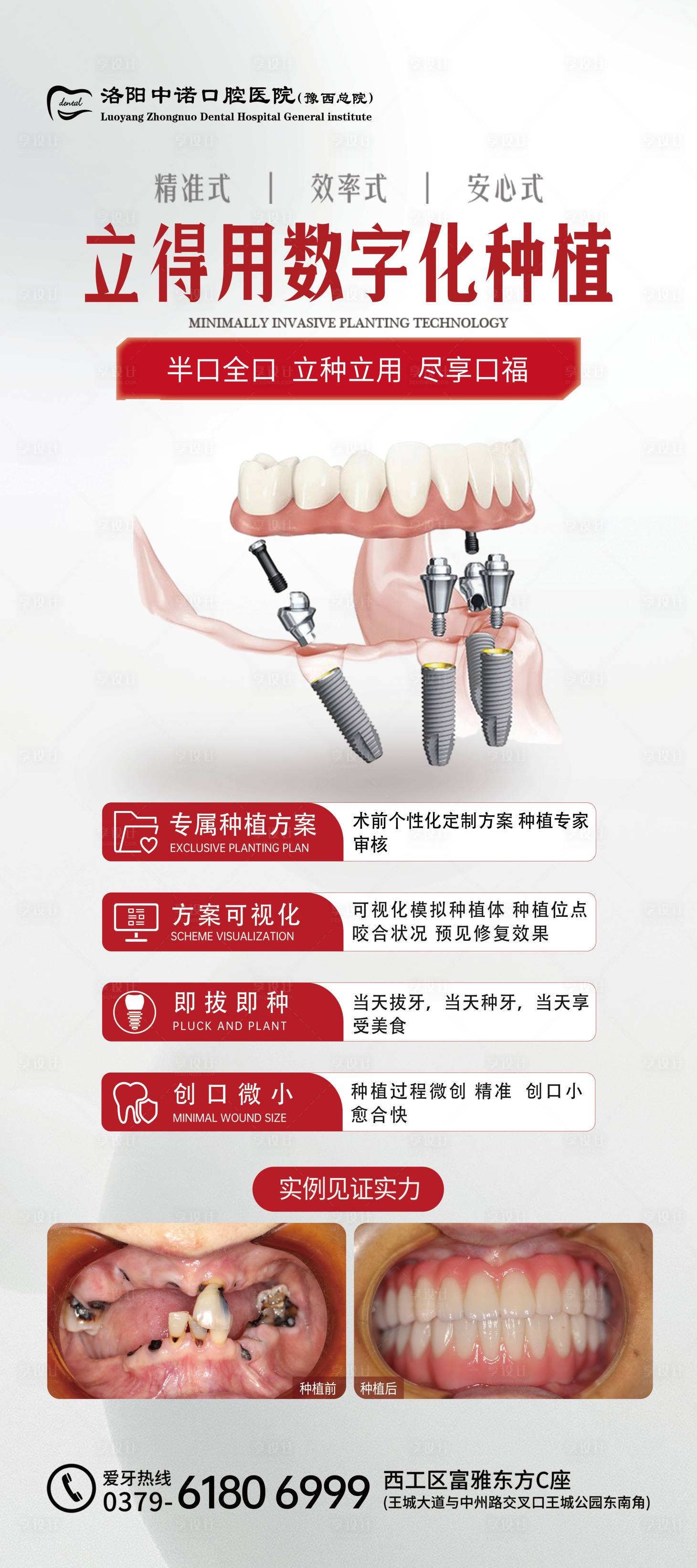 源文件下载【享设计】搜索编号：37600036048654502【立得用种植技术海报】