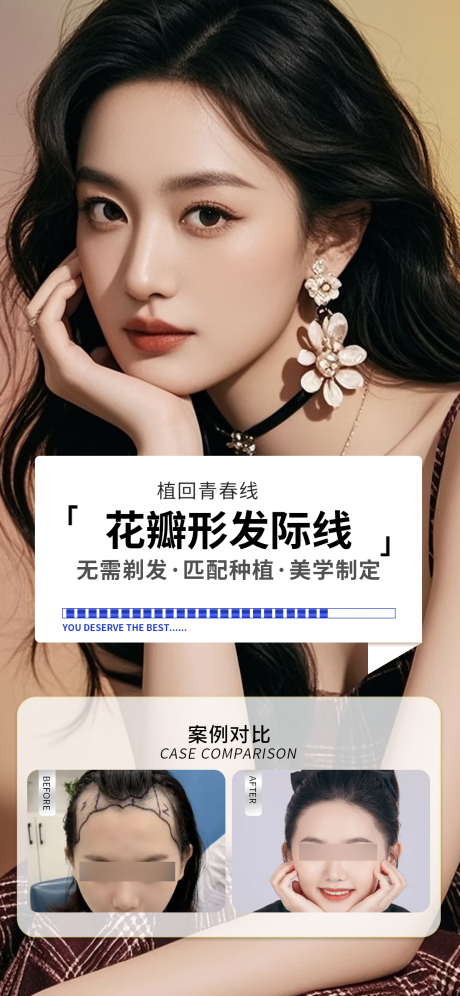 源文件下载【享设计】搜索编号：50700035841672149【医美发际线案例海报】