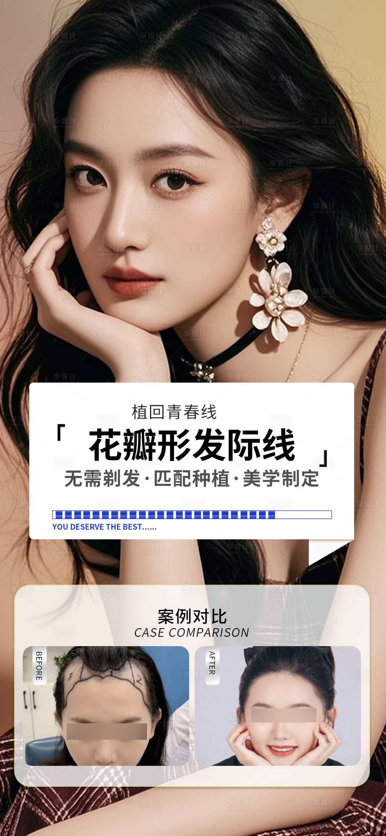 源文件下载【享设计】搜索编号：50700035841672149【医美发际线案例海报】