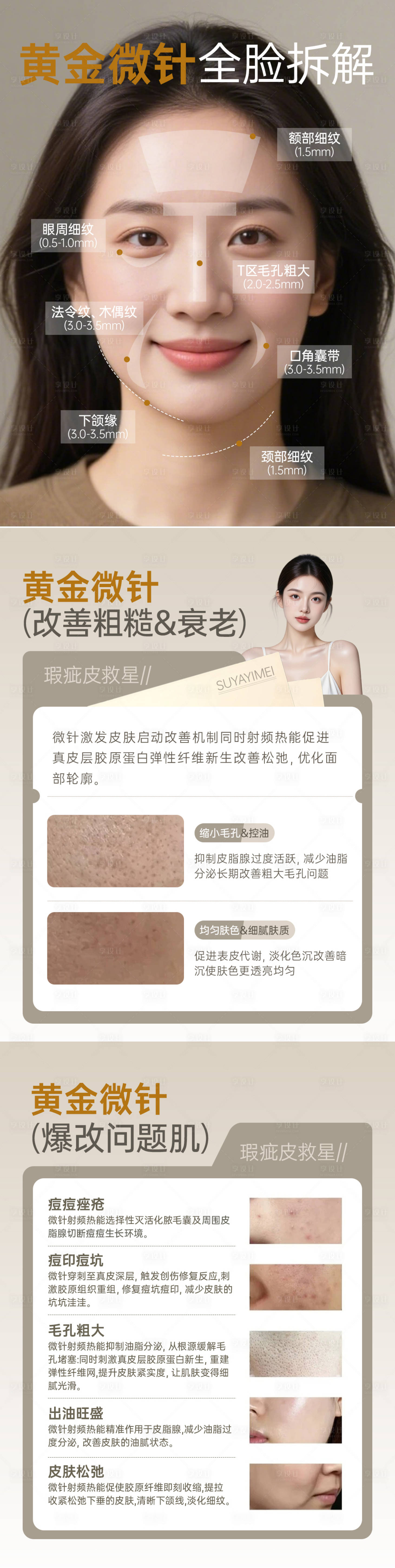 源文件下载【享设计】搜索编号：31020035993826628【黄金微针科普笔记】