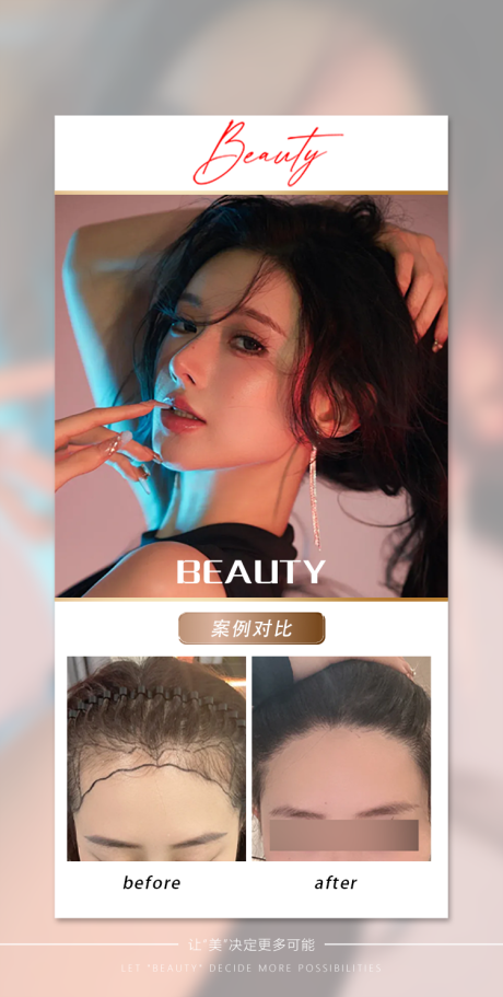 源文件下载【享设计】搜索编号：10750036092425324【头发案例海报】
