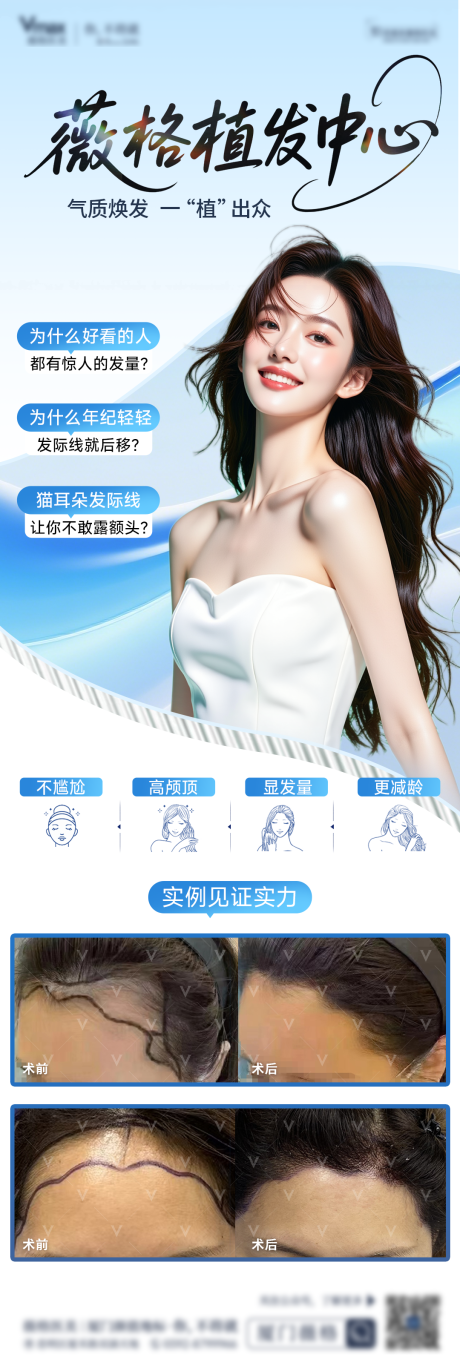 源文件下载【享设计】搜索编号：35540036006222343【植发发际线地中海生发创意案例海报】