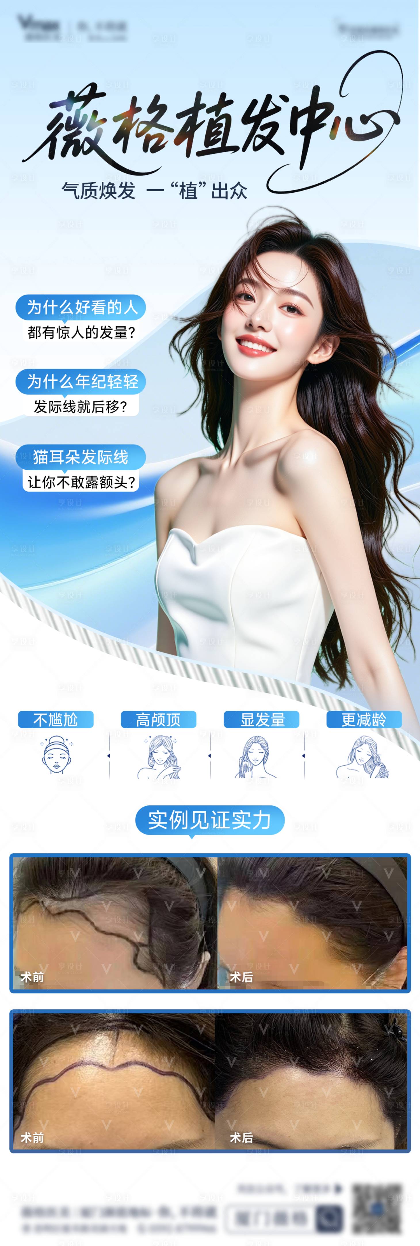 源文件下载【享设计】搜索编号：35540036006222343【植发发际线地中海生发创意案例海报】