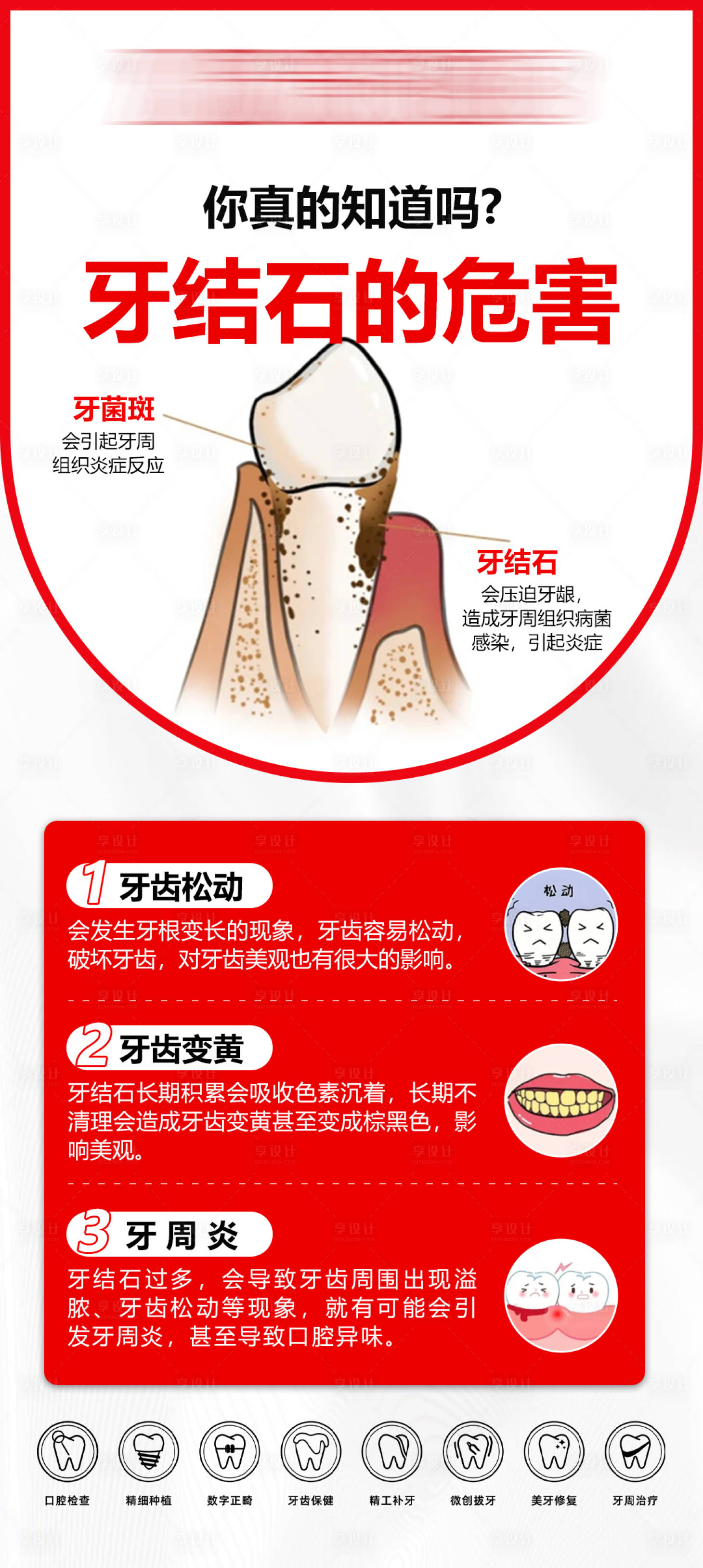源文件下载【享设计】搜索编号：27260036062335618【牙结石的危害】