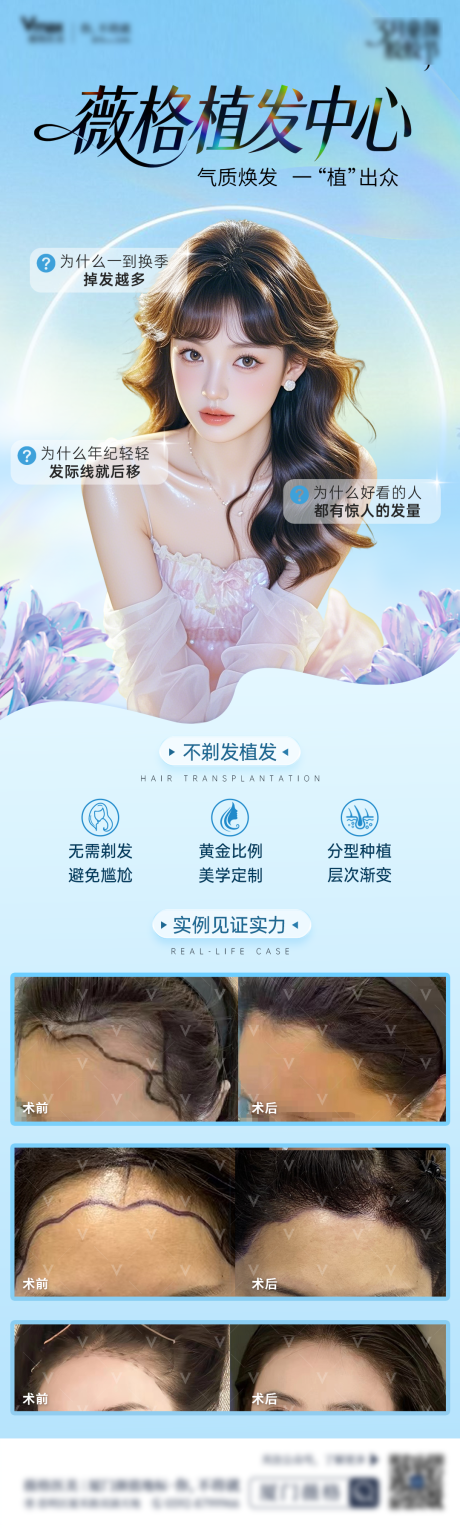 源文件下载【享设计】搜索编号：66910036007528816【植发发际线地中海生发创意案例海报】
