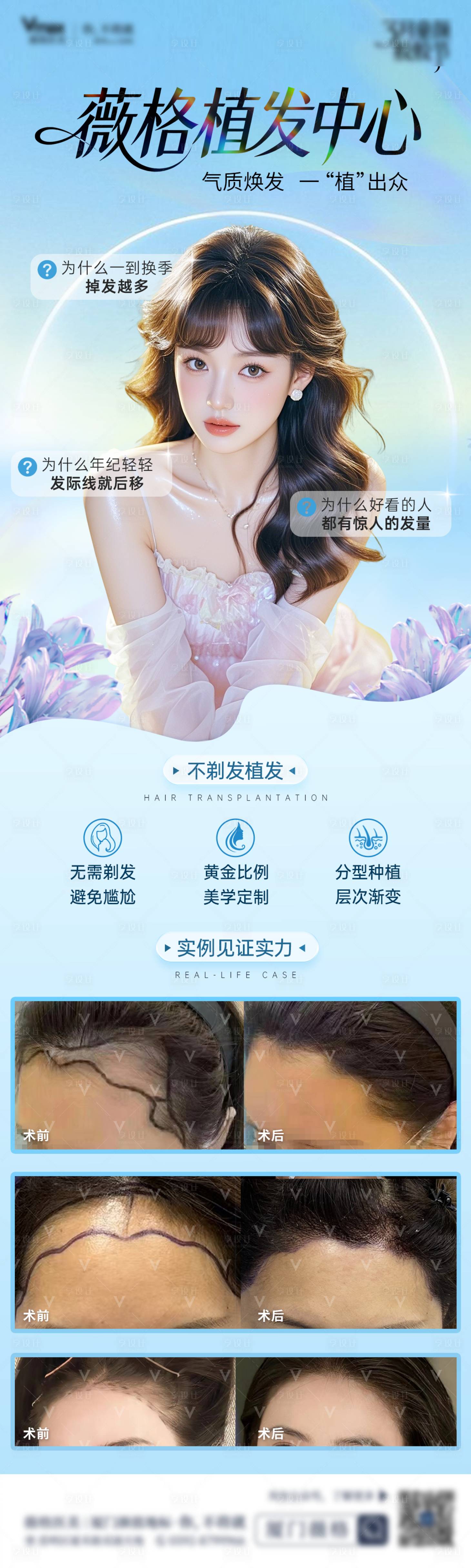 源文件下载【享设计】搜索编号：66910036007528816【植发发际线地中海生发创意案例海报】