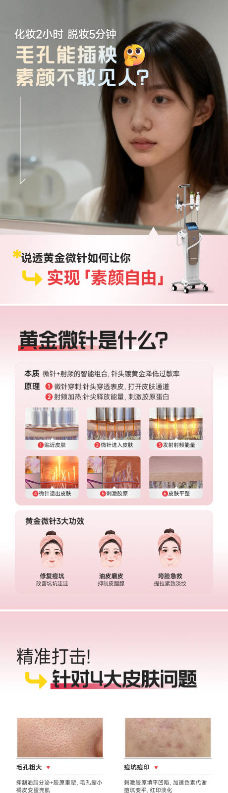 源文件下载【享设计】搜索编号：80850035918835448【黄金微针科普】