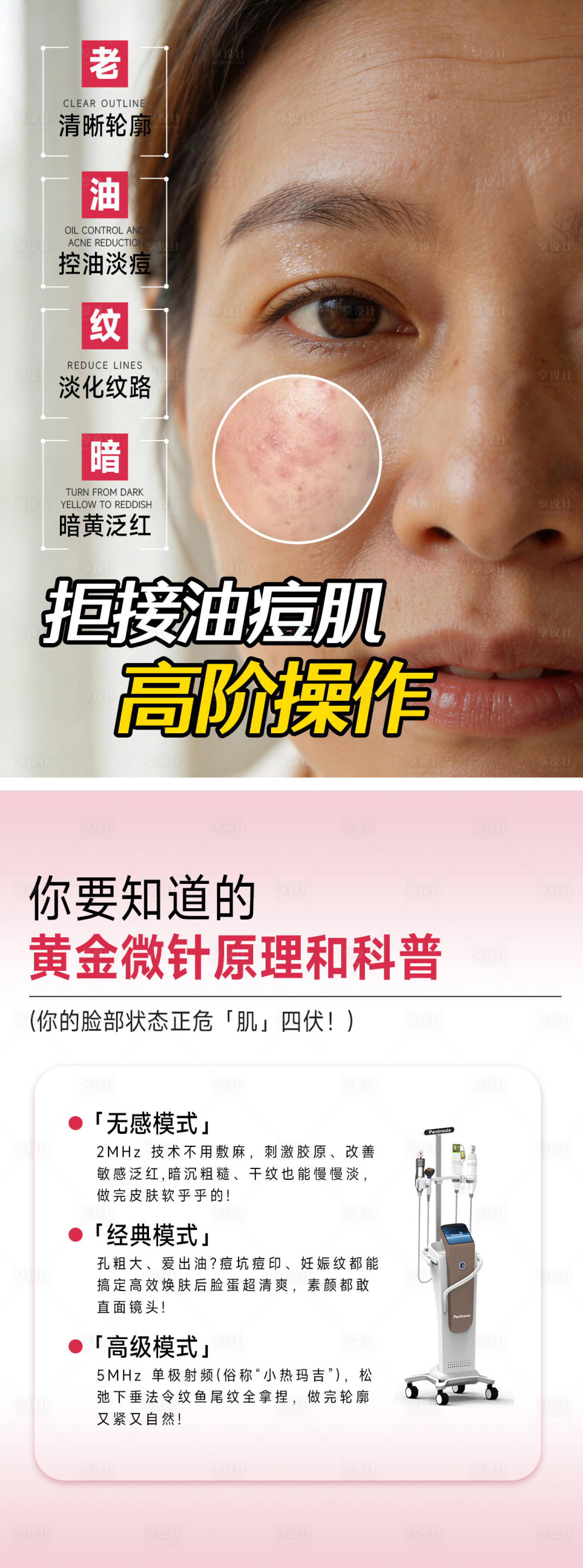 源文件下载【享设计】搜索编号：23800035753263617【黄金微针笔记科普】