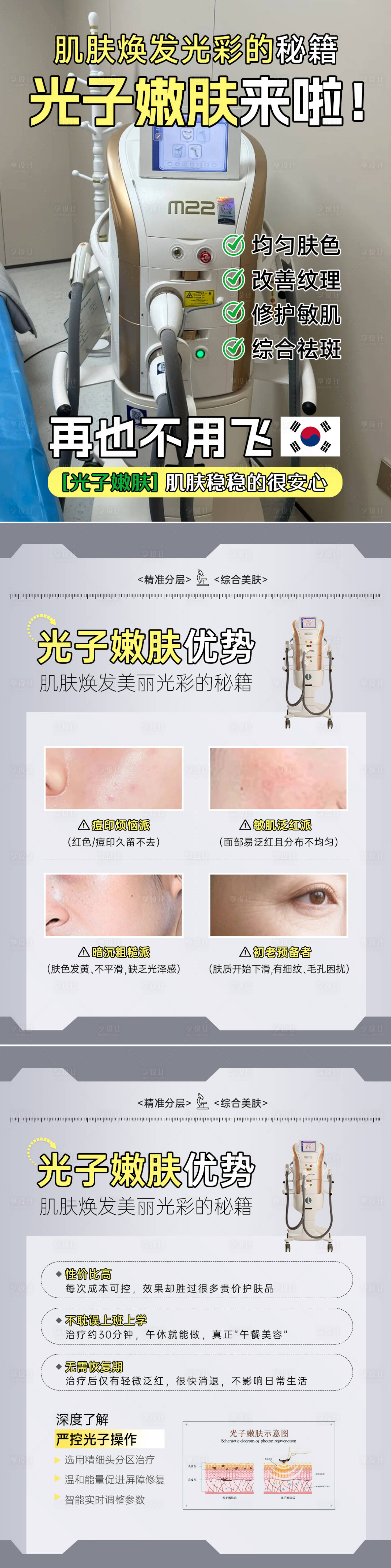 源文件下载【享设计】搜索编号：78860036132981003【光子嫩肤笔记科普】