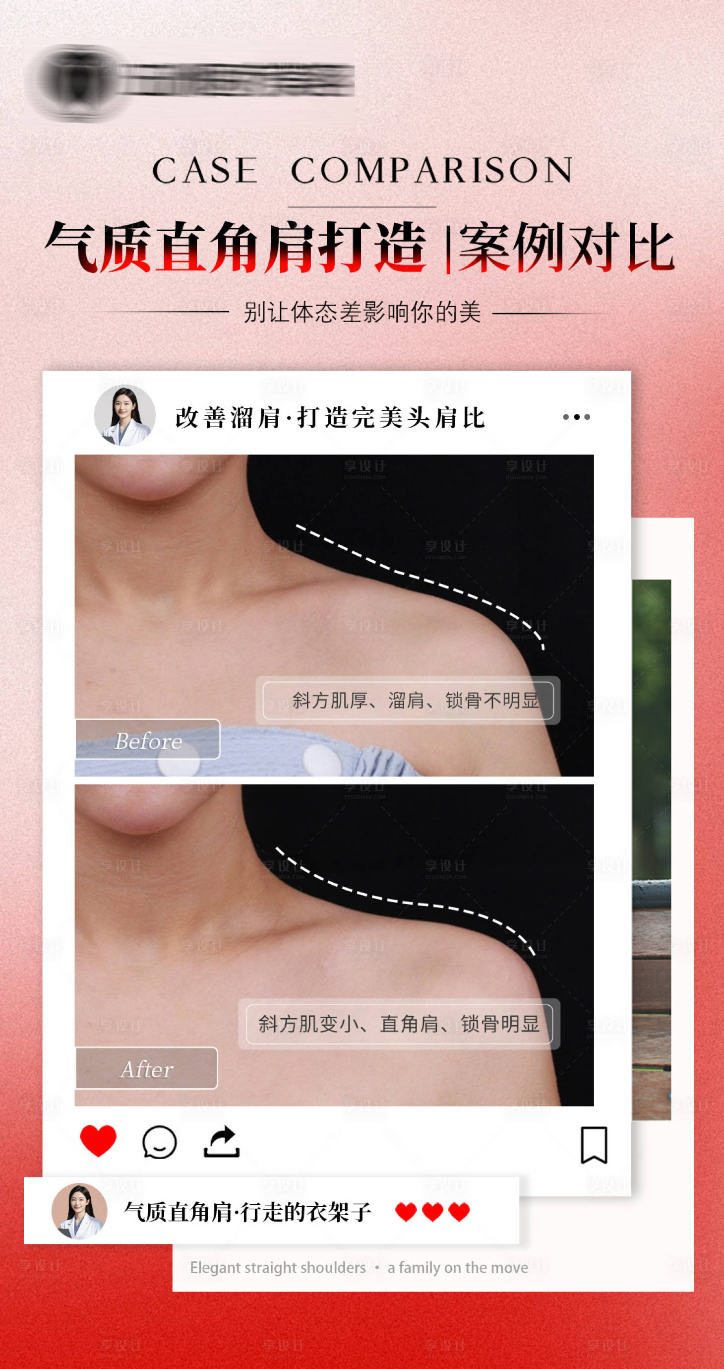 源文件下载【享设计】搜索编号：67770035757307072【医美案例对比】