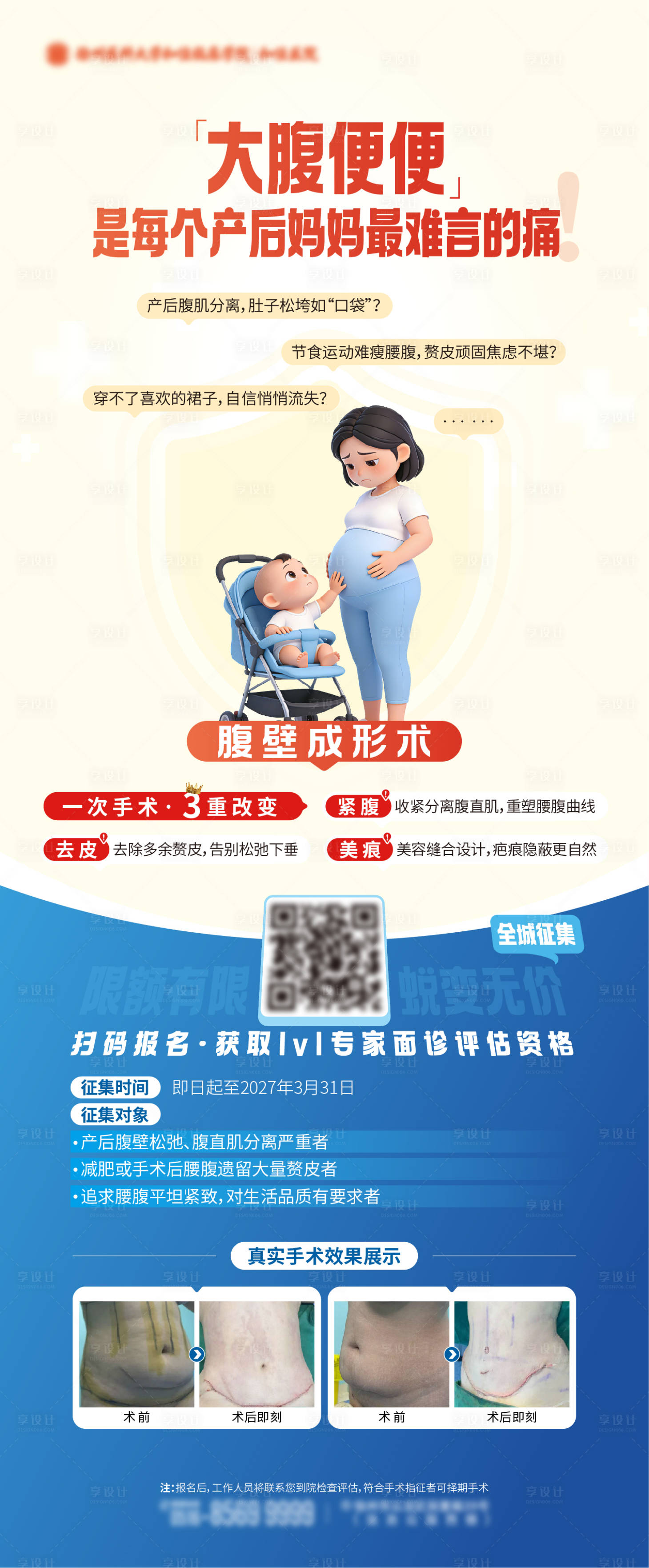 源文件下载【享设计】搜索编号：87260035628675821【医疗产后腹壁成形手术征集对比图海报】