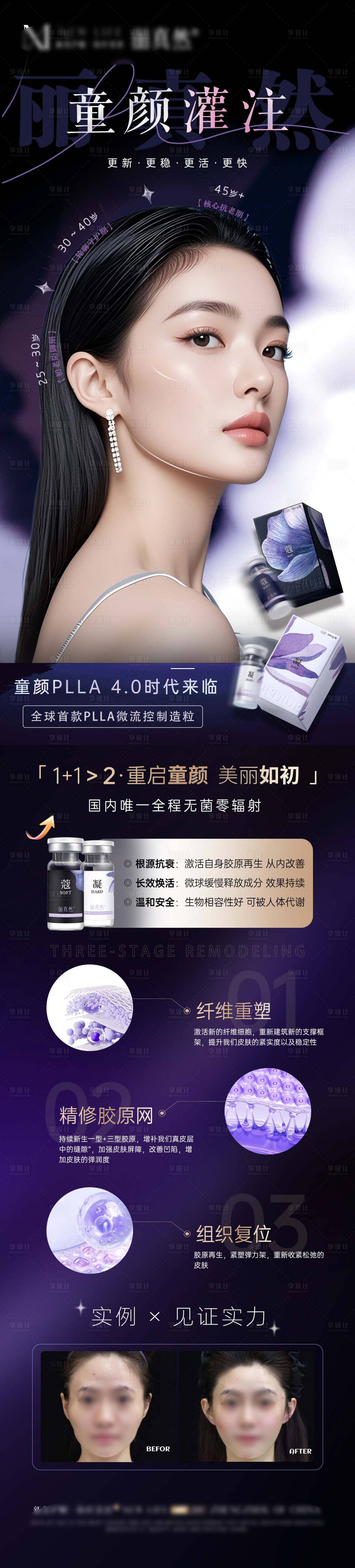源文件下载【享设计】搜索编号：16020035779661658【医美童颜灌注案例长图】