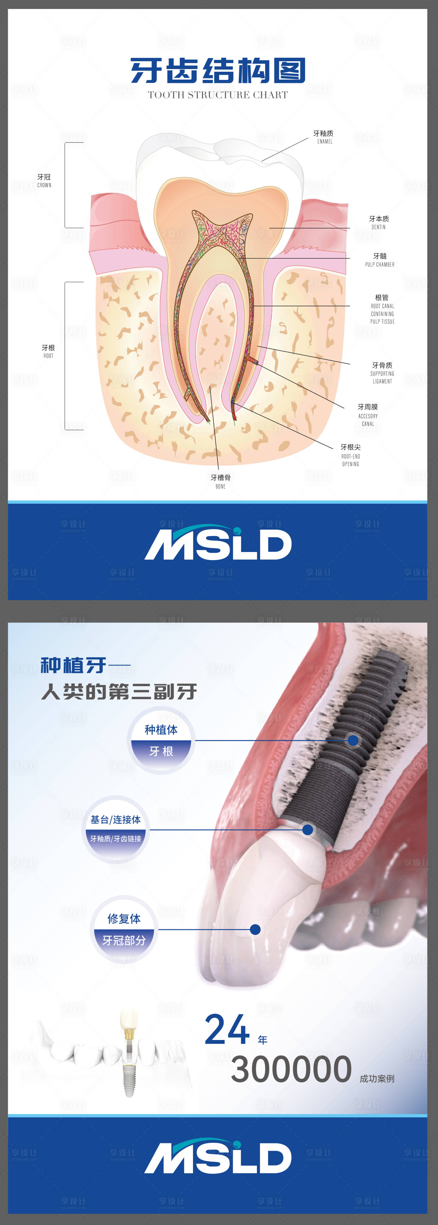 源文件下载【享设计】搜索编号：74890035943301120【口腔医院牙齿结构种植牙灯箱片海报】