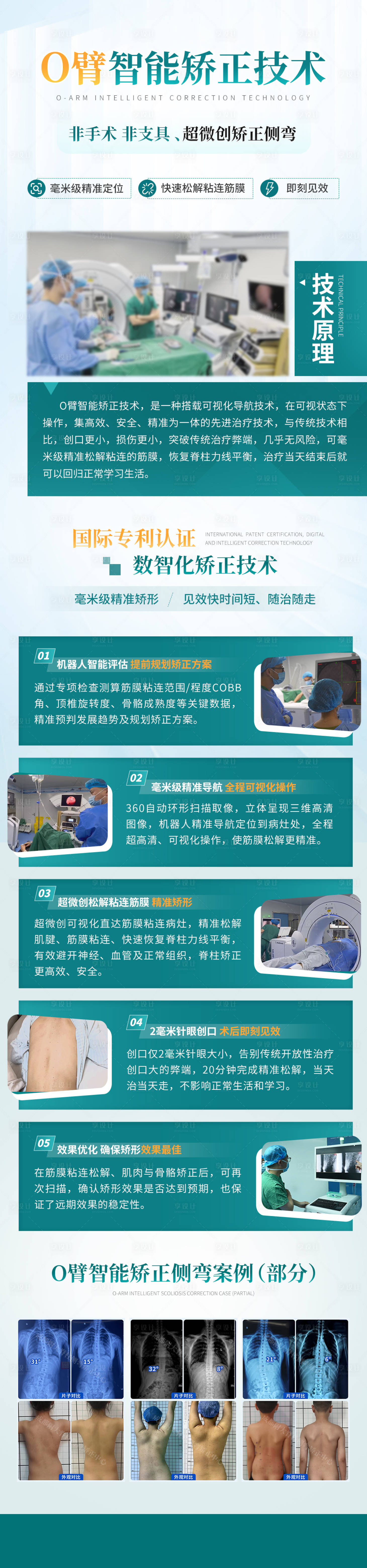 源文件下载【享设计】搜索编号：71960035604891925【医疗技术科普海报】