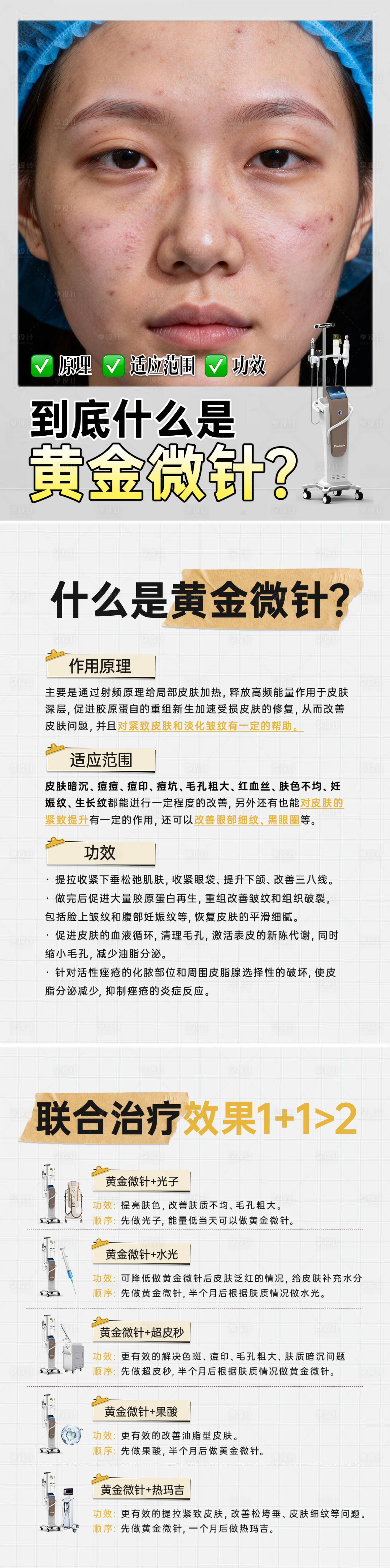源文件下载【享设计】搜索编号：20120035898409309【黄金微针科普笔记】