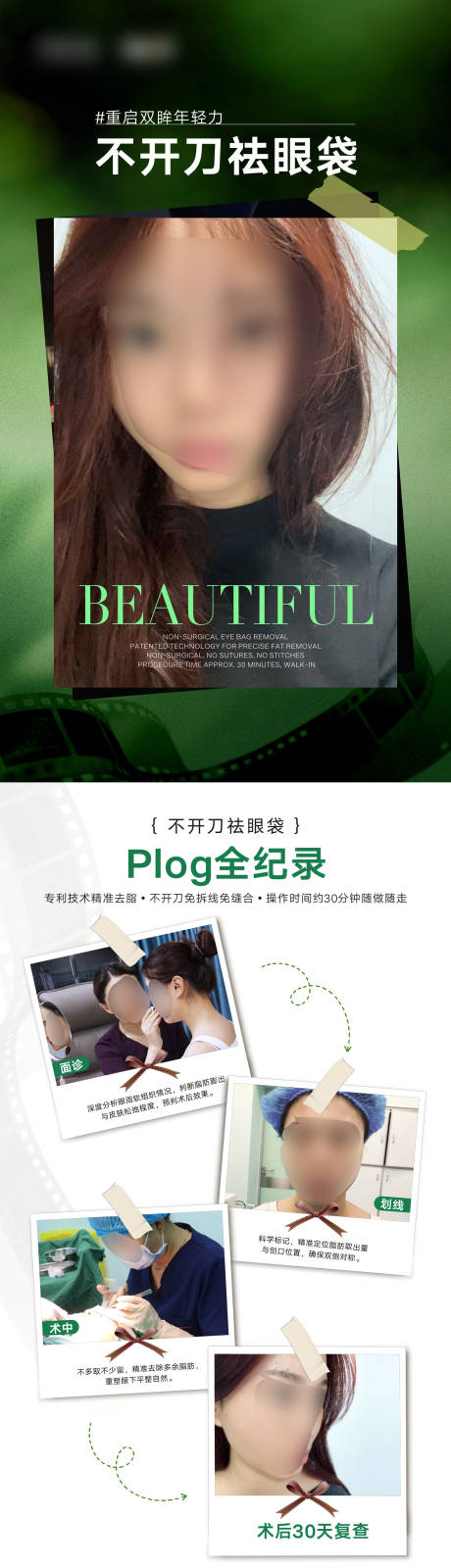 源文件下载【享设计】搜索编号：81280035926511583【不开刀祛眼袋案例海报】