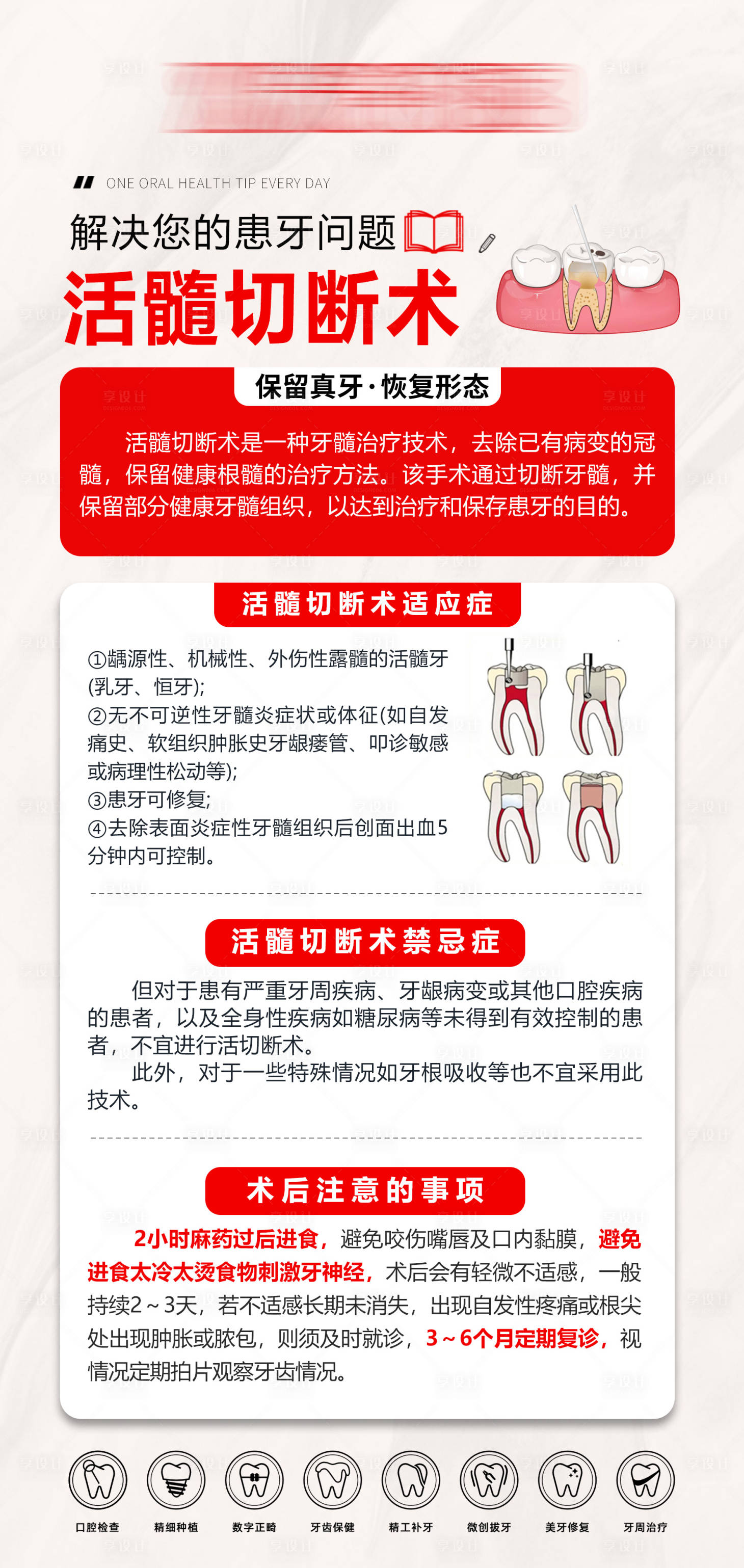 源文件下载【享设计】搜索编号：80820036067914432【活髓切断术海报】