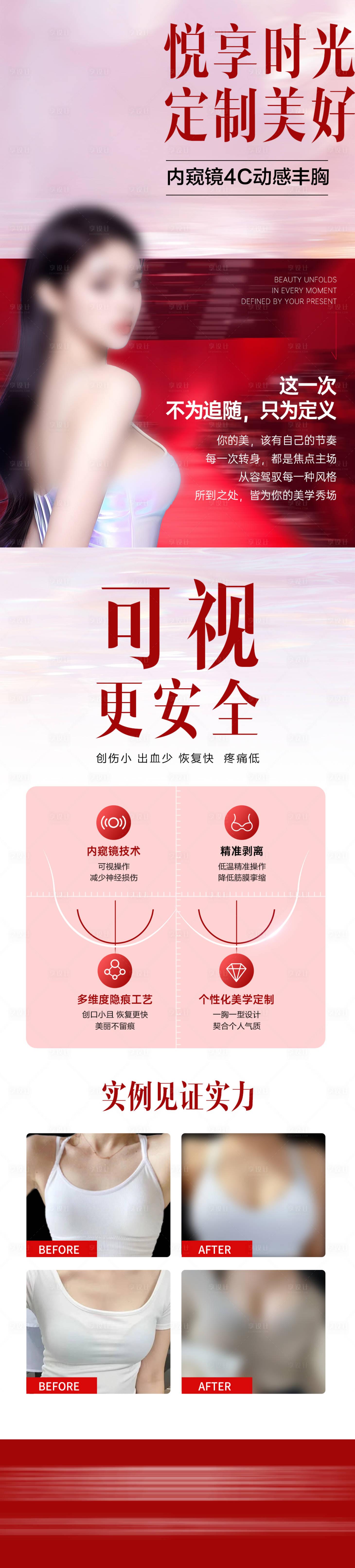 源文件下载【享设计】搜索编号：49220036006738089【医美内窥镜丰胸】