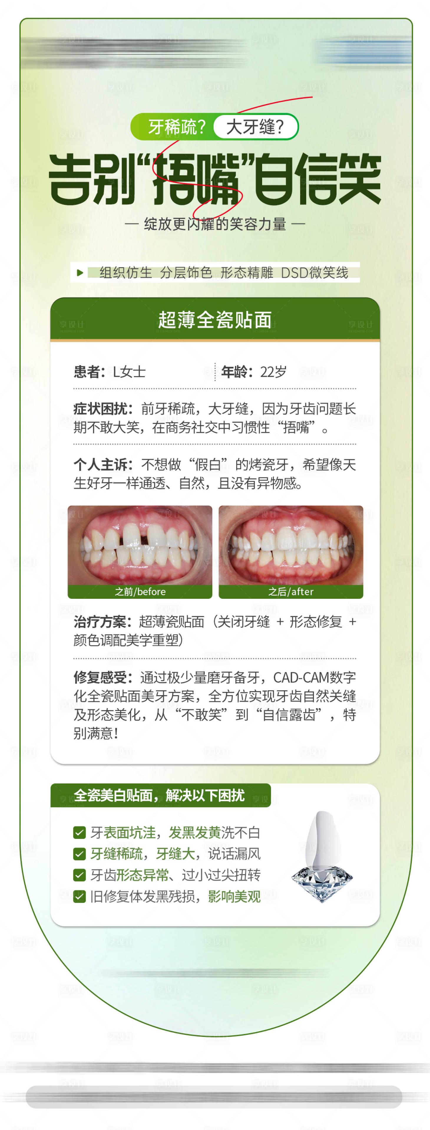 源文件下载【享设计】搜索编号：49410036061374376【口腔科普海报】