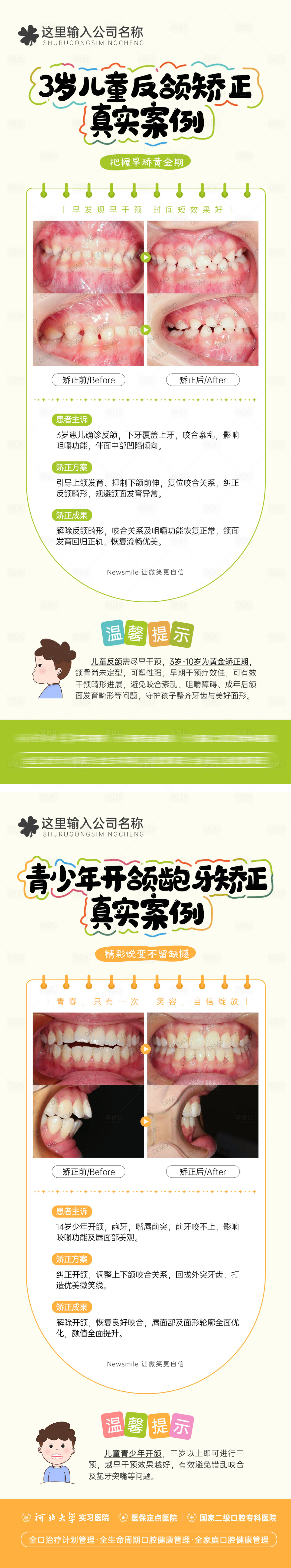 源文件下载【享设计】搜索编号：91220036015836974【儿童反颌矫正 青少年开颌龅牙矫正 】