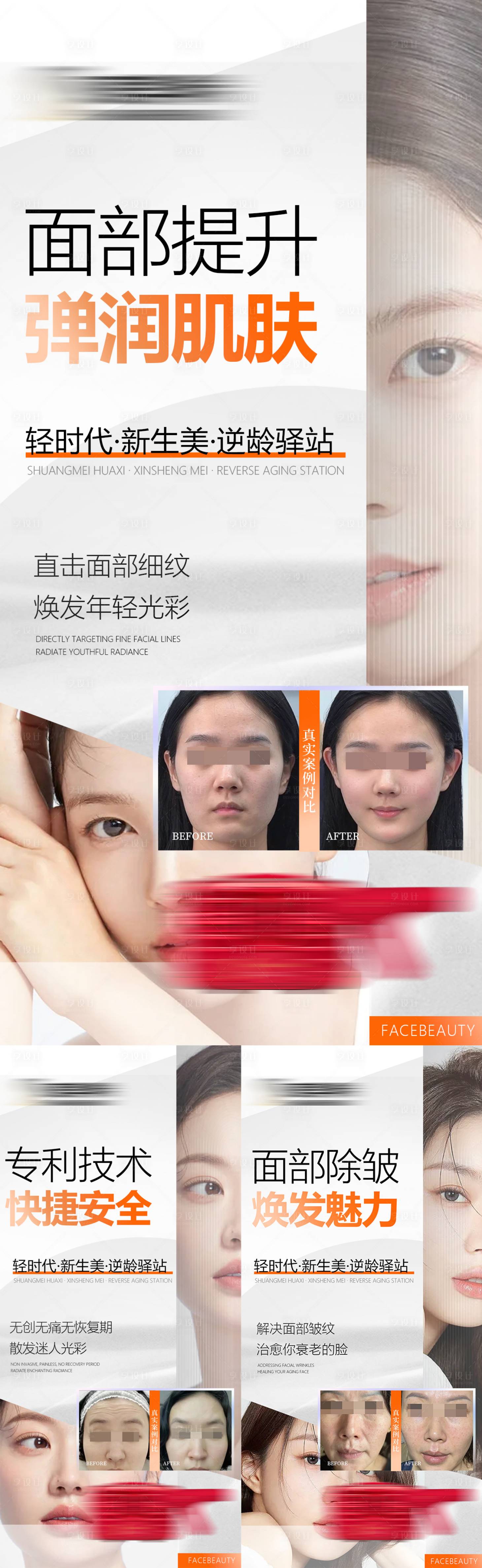 源文件下载【享设计】搜索编号：83080035796388527【医美案例对比图】