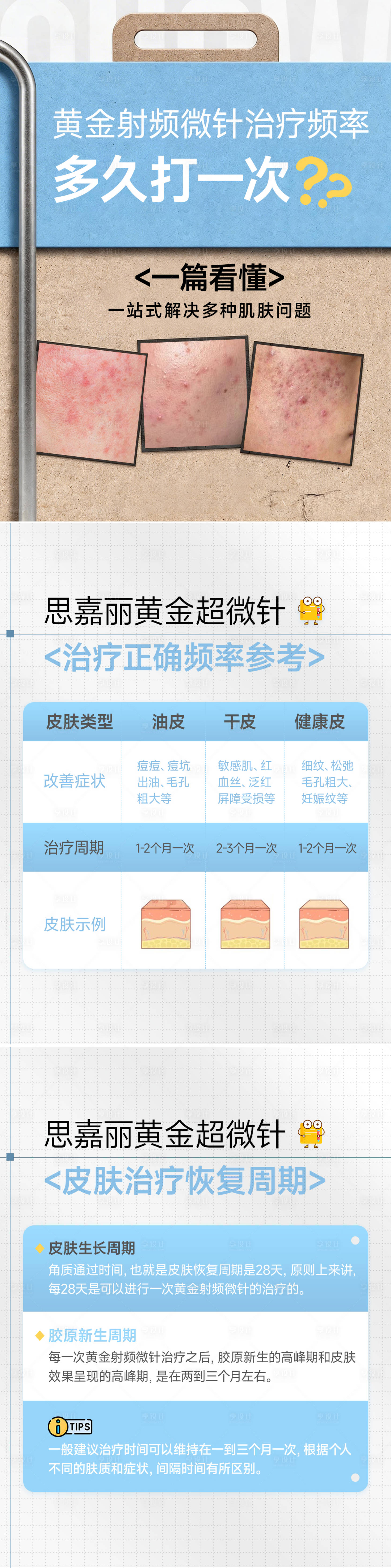源文件下载【享设计】搜索编号：60770036144145782【黄金微针科普海报】
