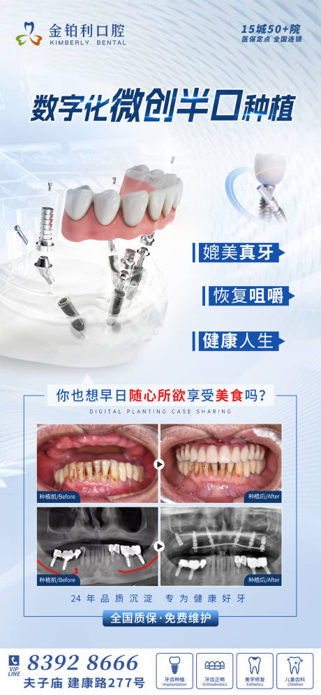 源文件下载【享设计】搜索编号：64600036109304249【口腔数字化种植牙案例海报】
