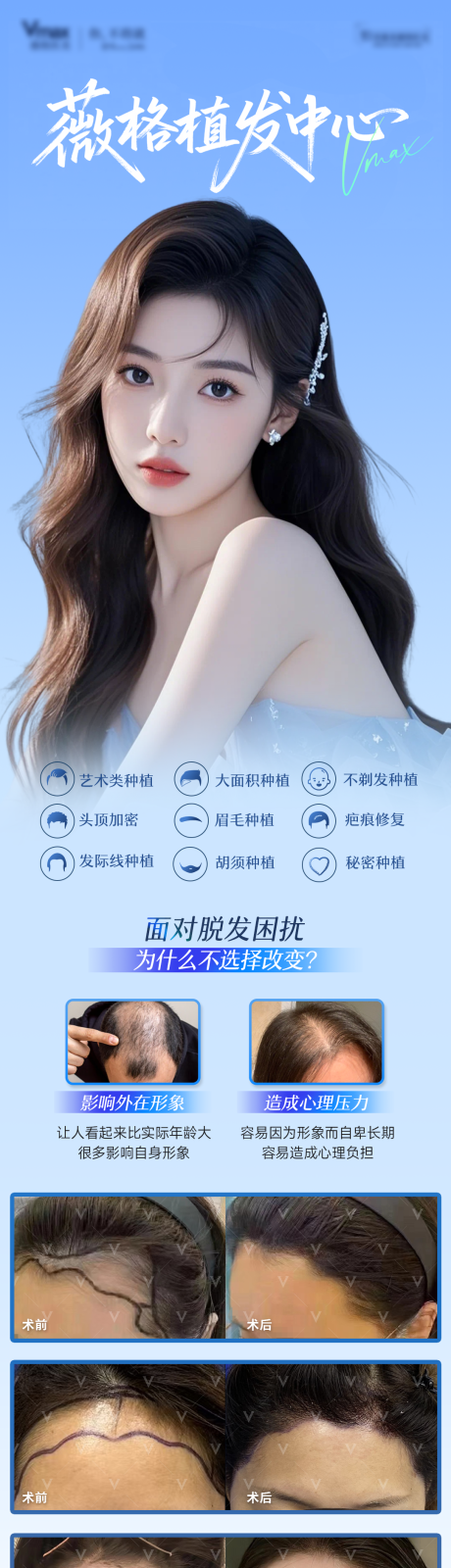 源文件下载【享设计】搜索编号：32650036005813984【植发发际线地中海生发创意案例海报】