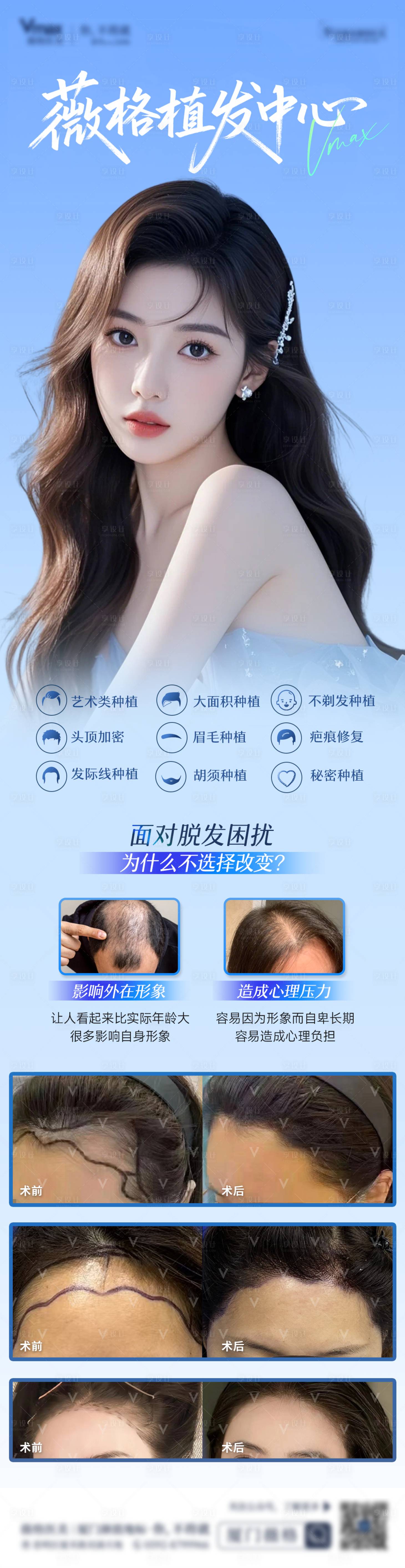 源文件下载【享设计】搜索编号：32650036005813984【植发发际线地中海生发创意案例海报】