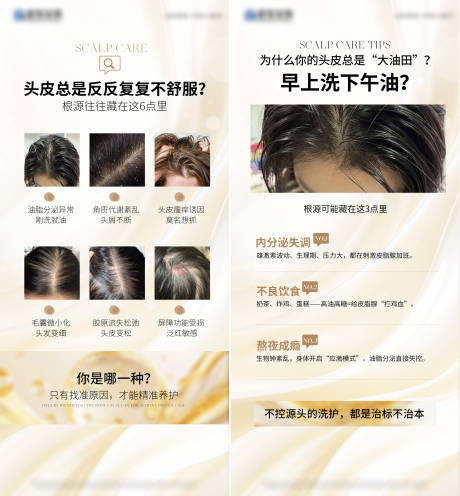 源文件下载【享设计】搜索编号：58400036004914915【头皮问题头皮科普 】