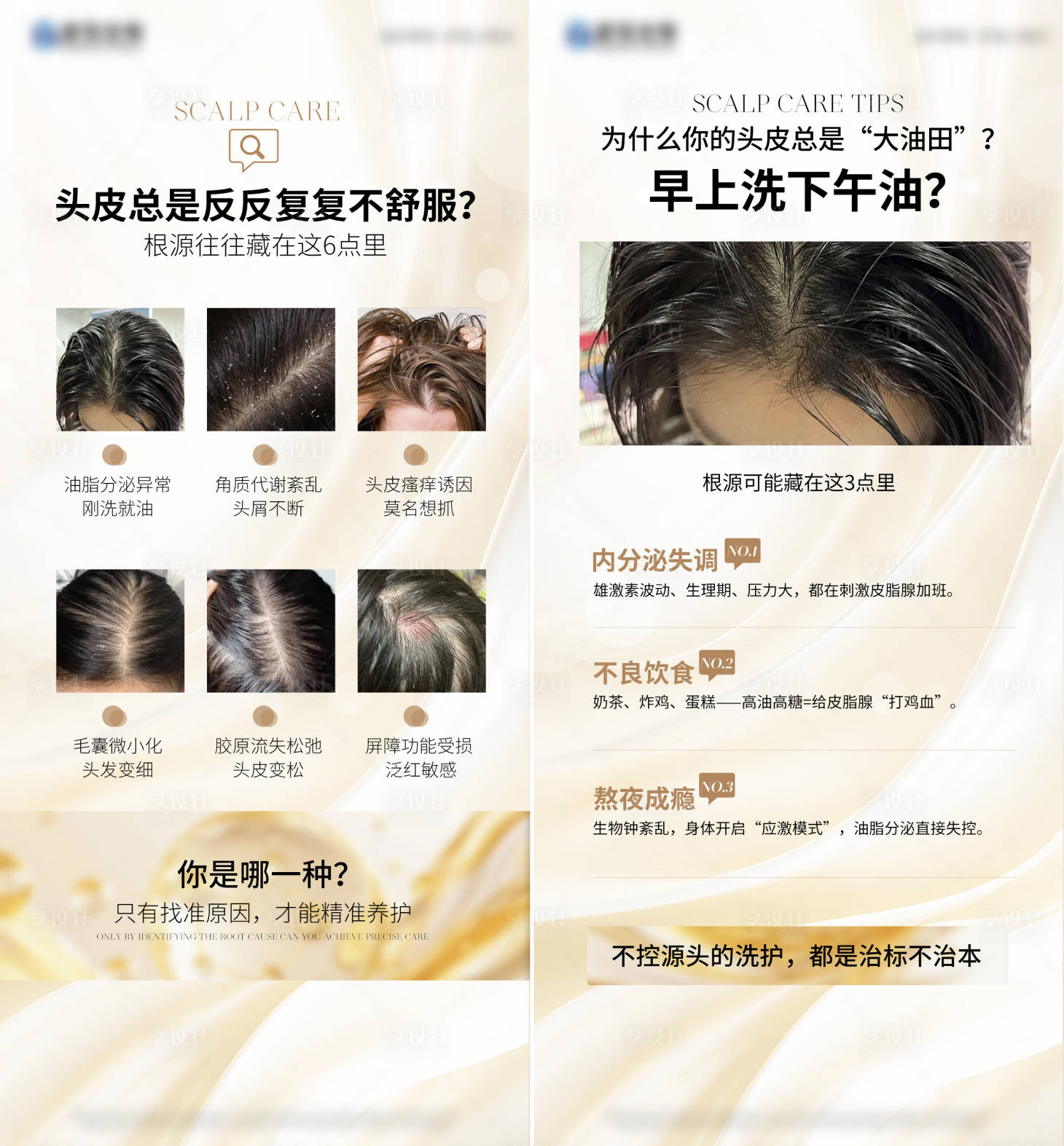 源文件下载【享设计】搜索编号：58400036004914915【头皮问题头皮科普 】