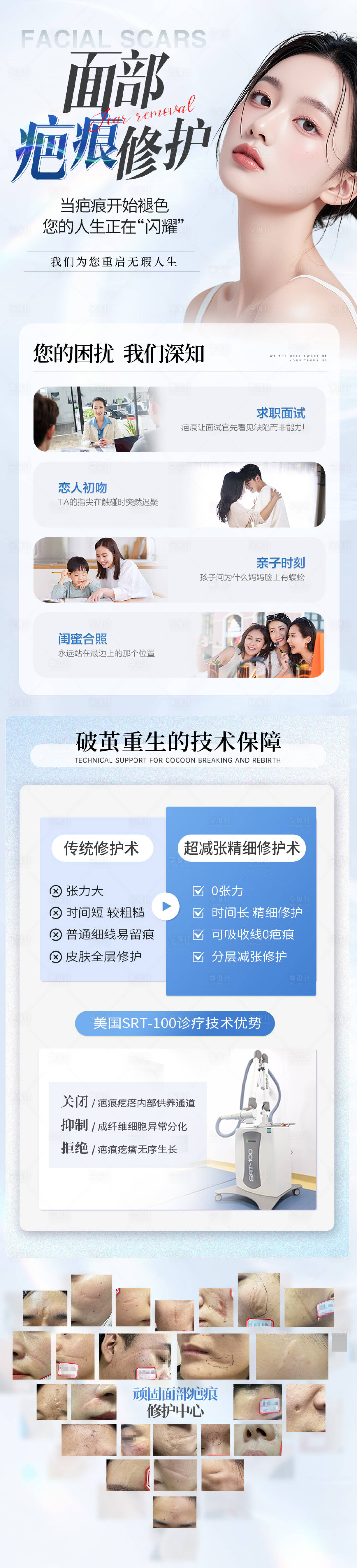 源文件下载【享设计】搜索编号：41300036374734505【医美疤痕蓝色落地页科普长图海展板海报】