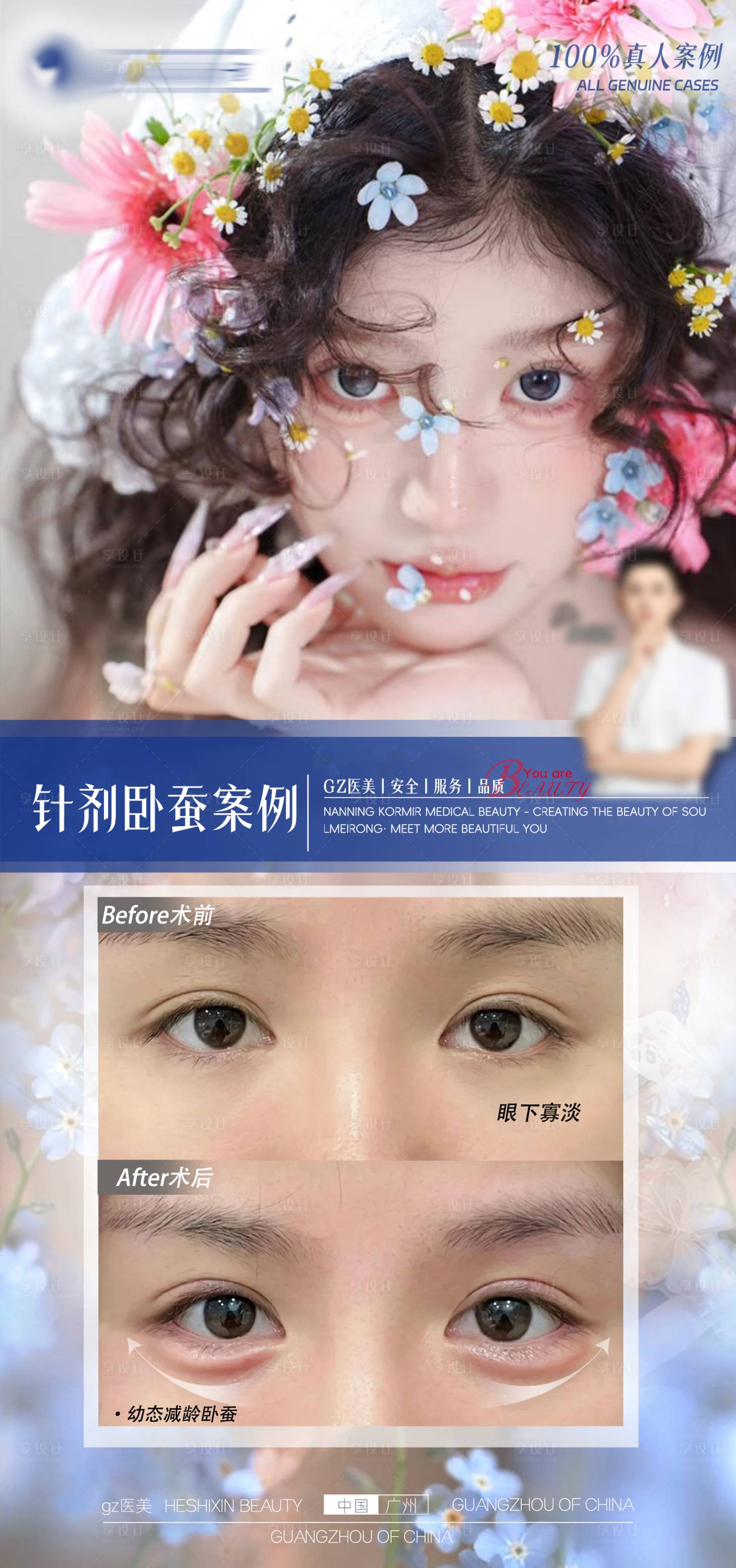 源文件下载【享设计】搜索编号：30310036505583921【魅力女神打造计划春日焕颜卧蚕对比海报】