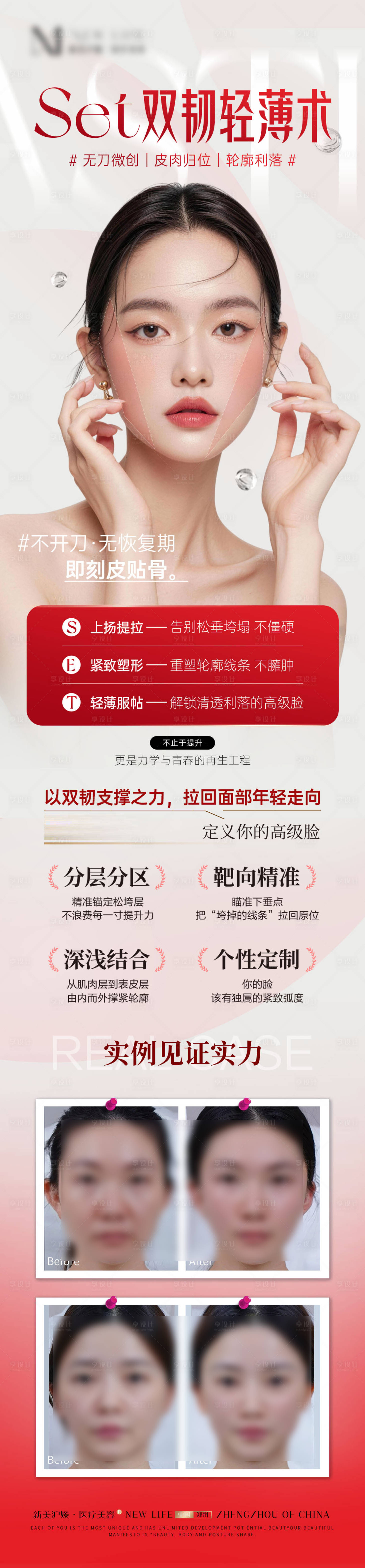 源文件下载【享设计】搜索编号：30270036259414675【医美面部提升线雕品相海报】